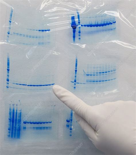 Protein electrophoresis gels - Stock Image - C009/7599 - Science Photo ...