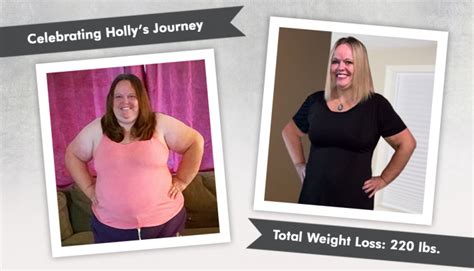 Before & After Duodenal Switch (DS) with Holly, losing 220 pounds ...