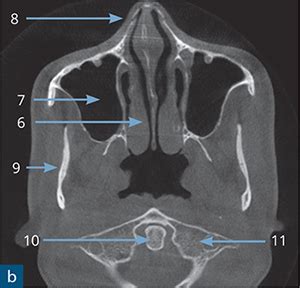 Dentoalveolar Anatomy | Pocket Dentistry