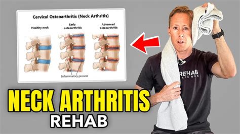 4 Exercises for Neck Arthritis - YouTube