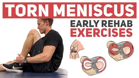 Meniscus Tear - Start With These Rehab Exercises - YouTube