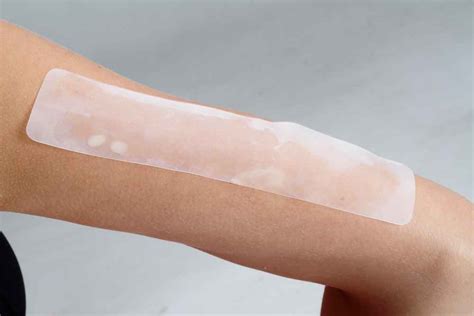 Scar Healing Silicone Sheet