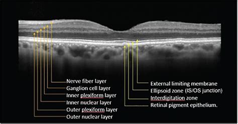 Ophthalmology Management | PentaVision