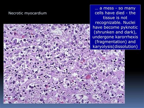 PPT - Necrosis and apoptosis PowerPoint Presentation, free download - ID:2289774