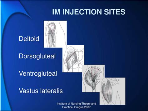 PPT - INTRAMUSCULAR INJECTION PowerPoint Presentation, free download ...