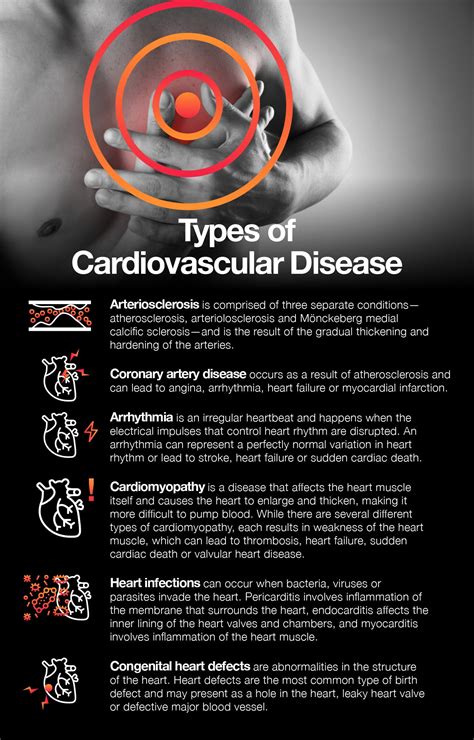 Cardiovascular Disease: Causes, Treatment, Prevention – The Amino Company