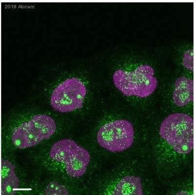 Anti-LAMP1 抗体 - Lysosome Marker (ab24170) | アブカム