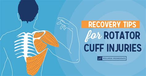 Recovery Tips for Rotator Cuff Injuries - AIRROSTI