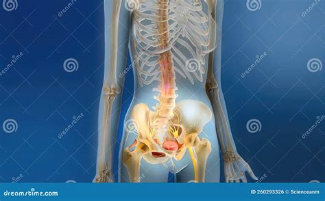 Sacral Nerve Stimulation, Also Known As Sacral Neuromodulation Stock Illustration - Illustration ...