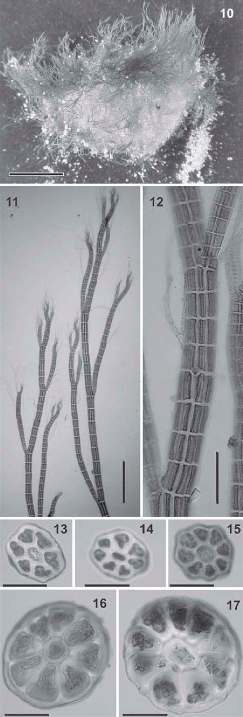 Polysiphonia foetidissima: vegetative morphology of Iberian specimens ...