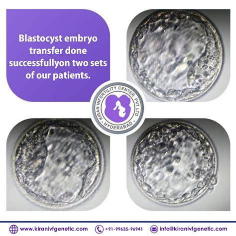 Blastocyst Embryo Transfer | Surrogacy india