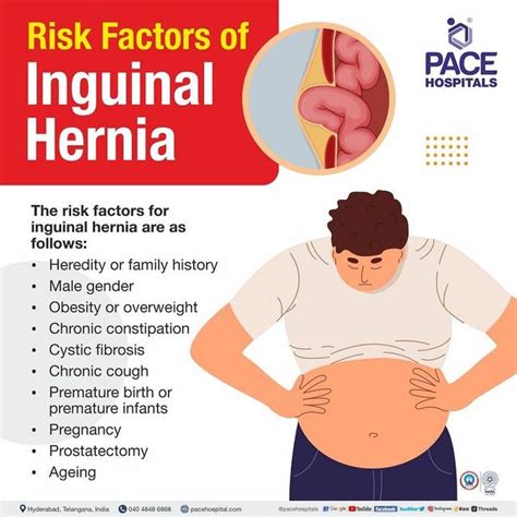 Inguinal Hernia Signs And Symptoms, Types, Causes, Risk, 58% OFF