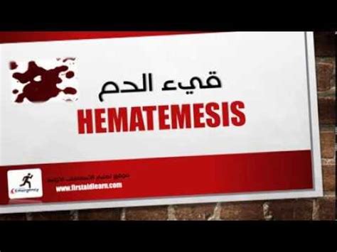 Hematemesis - قئ الدم - YouTube