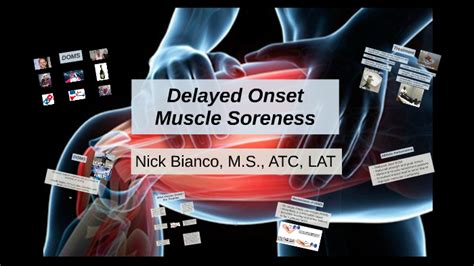 Delayed Onset Muscle Soreness