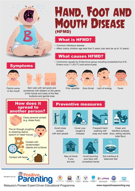 Hand, Foot and Mouth Disease (HFMD) | Positive Parenting | Hand foot ...