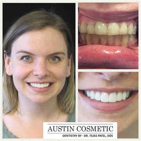 Cosmetic dentistry austin, texas - Dental News Network