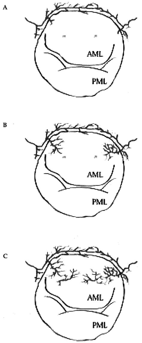 Schematic illustration of the general perfusion pattern of vessels in... | Download Scientific ...