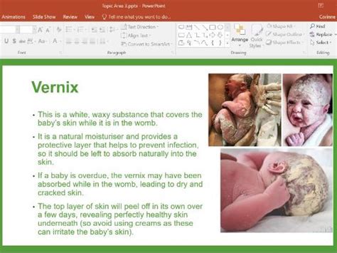 Child Development R057 Topic Area 3: Postnatal checks, postnatal care and the conditions for ...