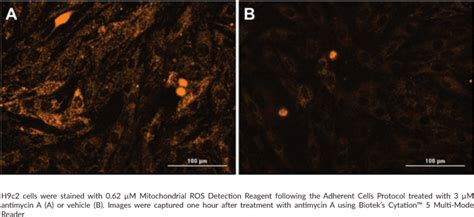 Mitochondrial ROS Detection Assay Kit