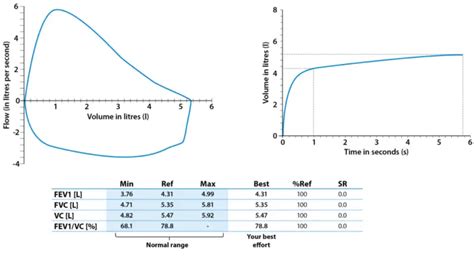 Spirometry: Procedure and All You Must Know | Healthtian