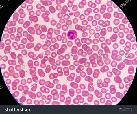 Red Blood Cells Under Microscope Labeled