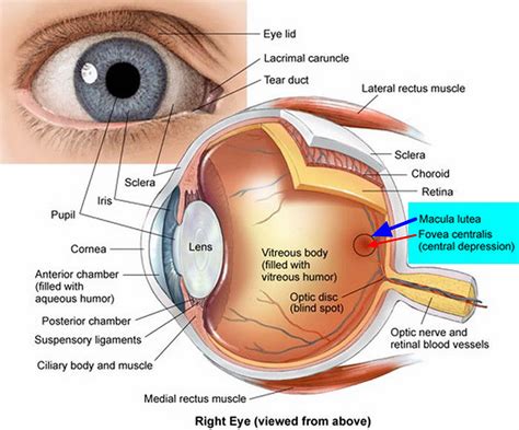 Macular degeneration - Age related, Causes, Types, Symptoms, Treatment