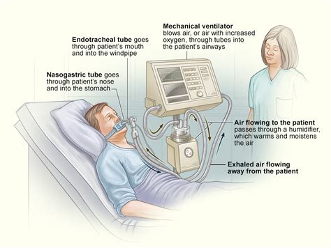 Ventilator/Ventilator Support - What Is a Ventilator? | NHLBI, NIH