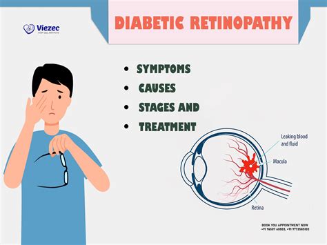 Diabetic Retinopathy – Symptoms, Causes, Stages, and Treatment