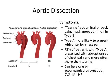 Aortic Dissection Causes