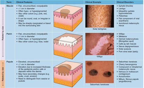 Introduction To Dermatology The Basics Describing Skin Lesions ...