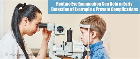 ++ 50 ++ exotropia vision 130831-Alternating exotropia vision therapy ...