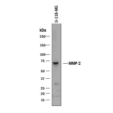 Human MMP-2 Antibody AF902: R&D Systems