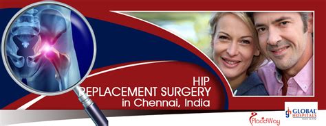 Affordable Oxinium Total Knee Replacement Surgery in Chennai India