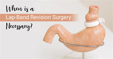 When is a Lap-Band Revision Surgery Necessary? : ObesityHelp