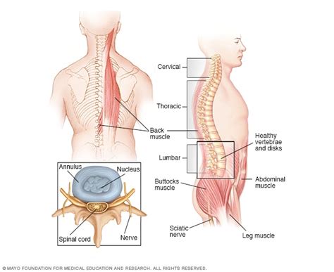 Tumor de la médula espinal - Síntomas y causas - Mayo Clinic