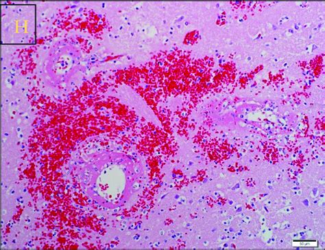 Infection with Babesia rossi causes severe disease. (A) Collapse at... | Download Scientific Diagram