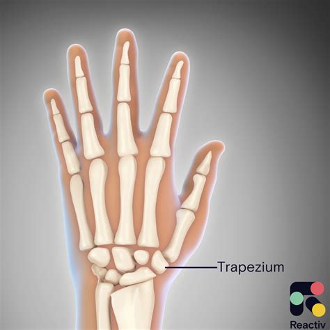 Surgery for Thumb Arthritis: What are the Options? – Reactiv Blog