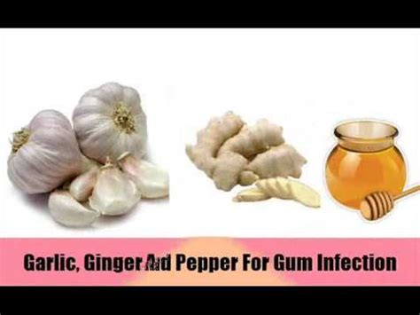 13 Excellent Home Remedies For Gum Infection - YouTube