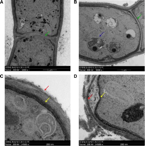 Effect of pyraclostrobin on cell ultrastructure of Coniella granati... | Download Scientific Diagram