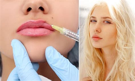 A new lip enhancement technique is entering the mainstream | Daily Mail Online