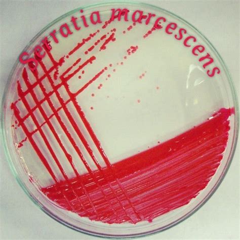 Antibiotic for serratia marcescens