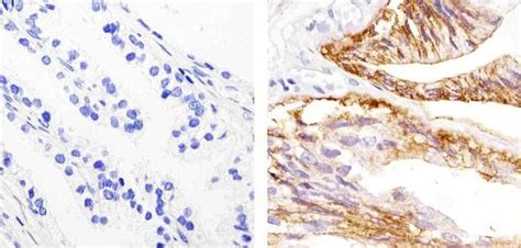 EpCAM Antibody (MA5-12442)