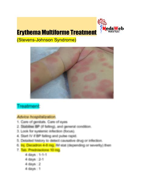 SOLUTION: Erythema multiforme treatment - Studypool