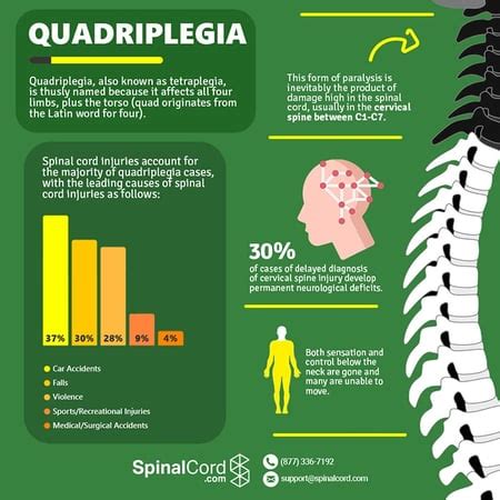 Quadriplegia & Tetraplegia: Definition, Causes, Symptoms, and Treatment