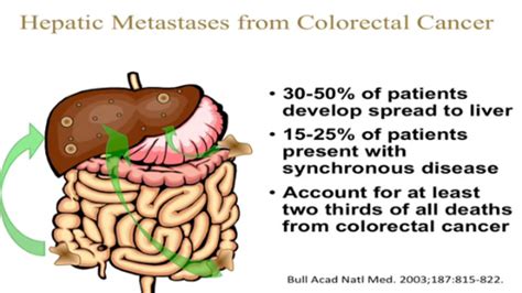 Colorectal Liver Metastases with Extrahepatic Disease: Surgical ...