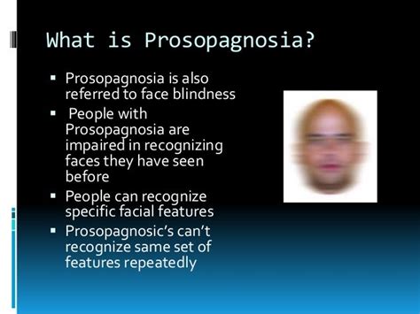 Prosopagnosia