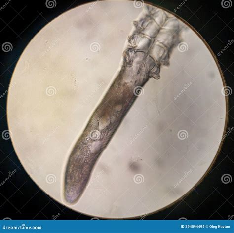 Demodex Folliculorum - Parasitic Mite on the Eyelashes of a Human Eye Stock Photo - Image of ...