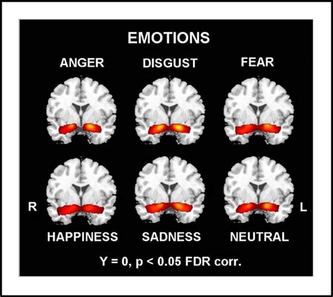 General and specific responsiveness of the amygdala during explicit emotion recognition in ...