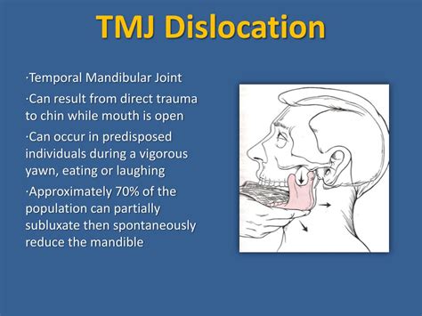 PPT - Facial Trauma PowerPoint Presentation, free download - ID:2392727