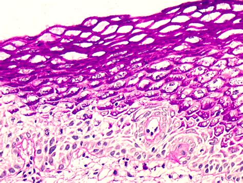 Histopathology of the uterine cervix - digital atlas